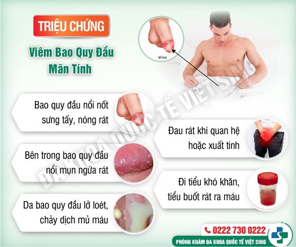 https://benhtrivietsing.com/wp-content/uploads/2023/06/bacninh-nk-baoquydau-tổng9-01.jpg