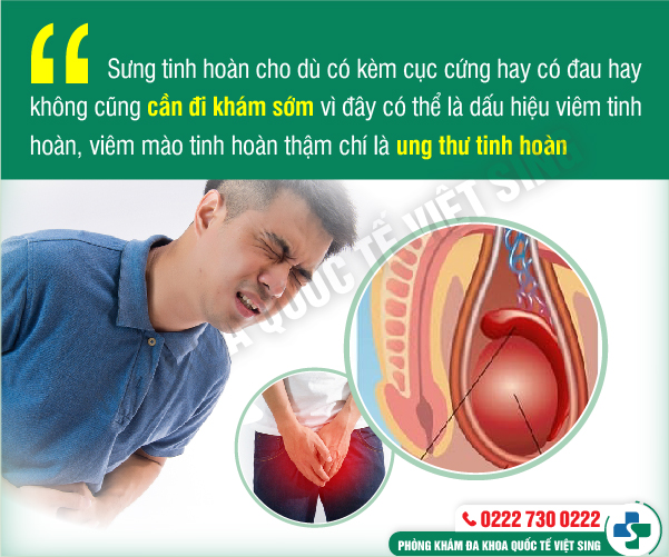 https://benhtrivietsing.com/wp-content/uploads/2023/06/sung-tinh-hoan.jpg