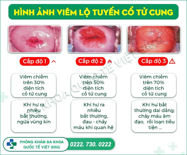 https://benhtrivietsing.com/wp-content/uploads/2023/07/Anh5-1-1.png