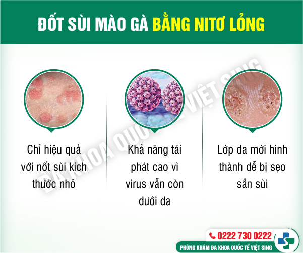https://benhtrivietsing.com/wp-content/uploads/2023/07/bacninh-nk-xahcay-08.jpg
